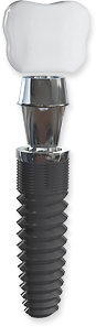 implants hardware